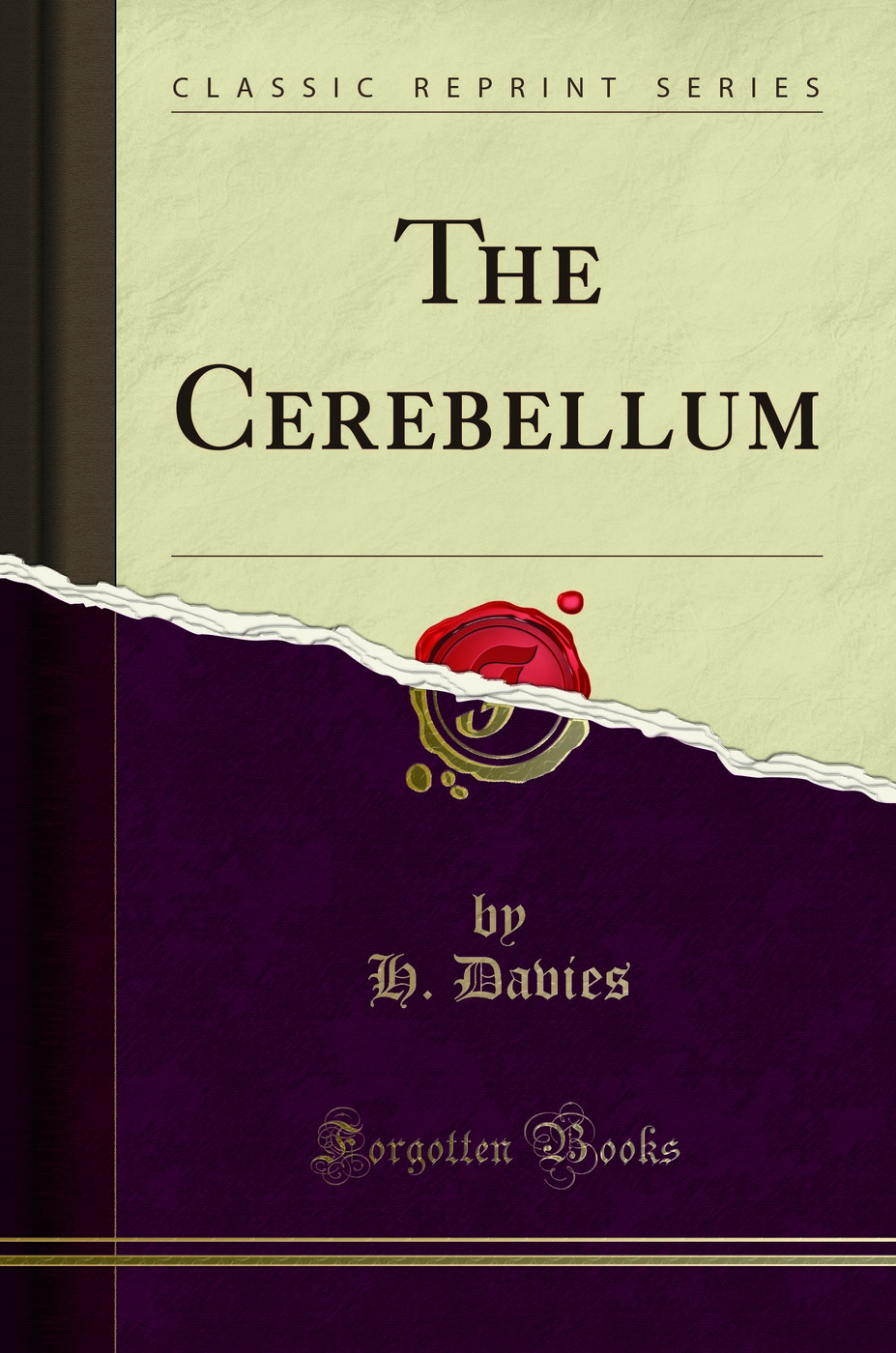 The Cerebellum (Classic Reprint)