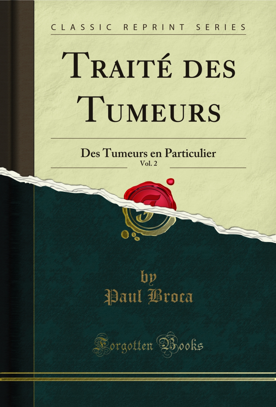Traité des Tumeurs, Vol. 2: Des Tumeurs en Particulier (Classic Reprint)