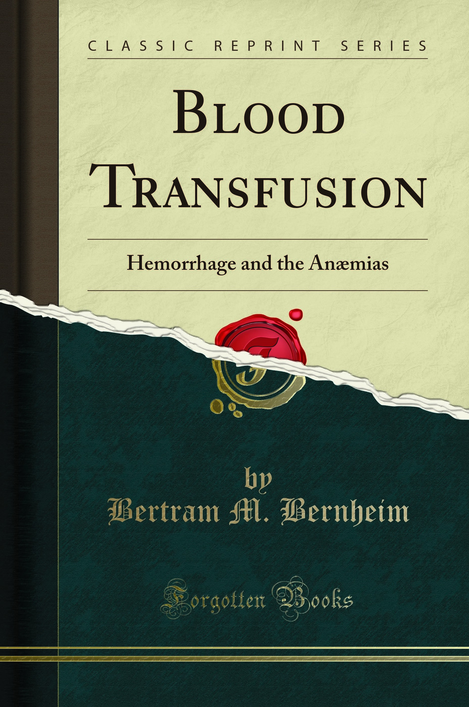 Blood Transfusion: Hemorrhage and the Anæmias (Classic Reprint)